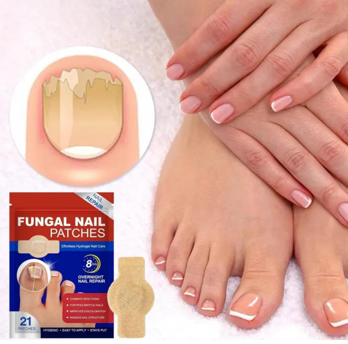 FungiFix™ Parches para Uñas Elimina Hongos 21 Parches